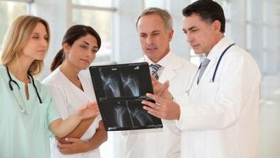Options d'arthrite et thérapie d'ostéose