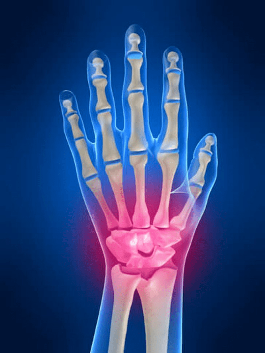 Arthrite commune