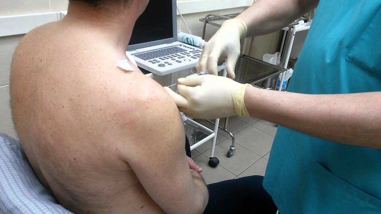 injection d'épaule pour l'arthrose