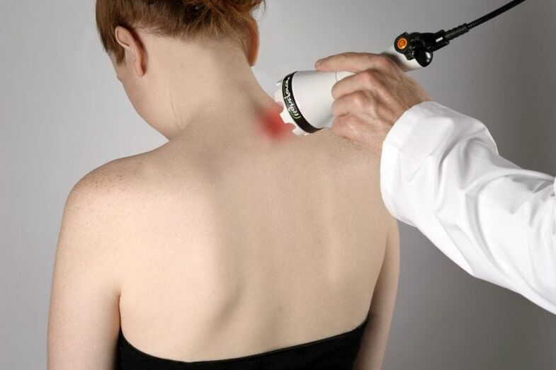 Traitement au laser de l'ostéochondrose cervicale chez la femme.